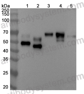 Anti-HRSV-A/BRSV F/Fusion glycoprotein F0 Antibody (B13-1)